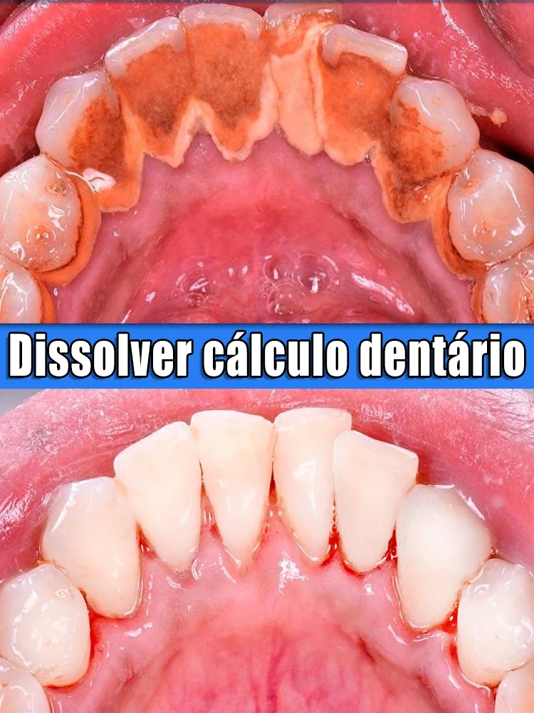 Resolva todos os problemas dentários