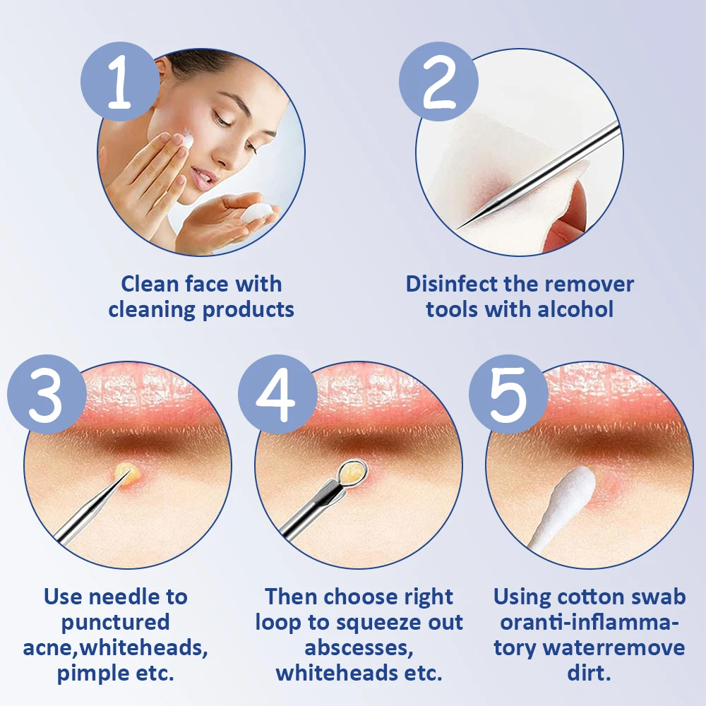 11 Stuks Acne Naald Mee-eter Clip Remover Extractie Porie Schoon Naald Gezicht Huidverzorging schoonheid Verwijdering Smet Acne Tool