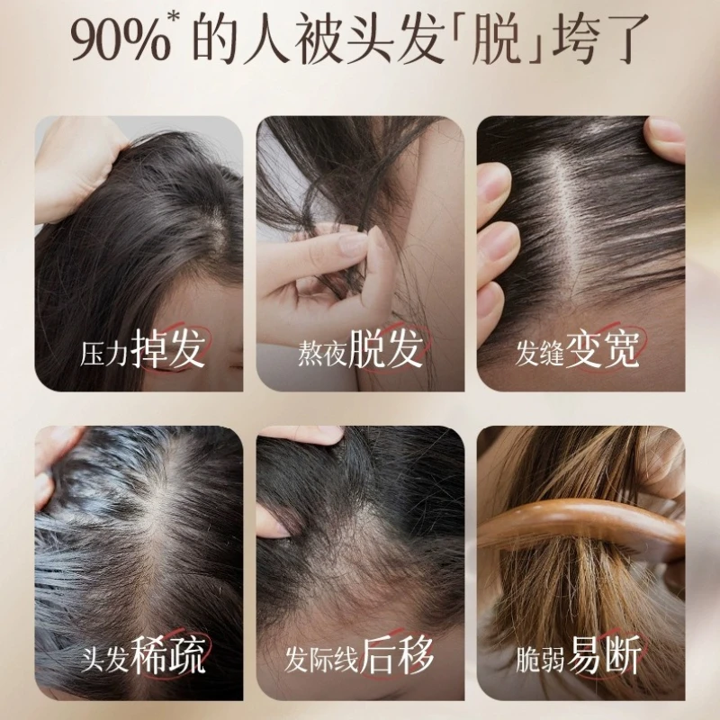 Anti-Breakage Volumizing Shampoo 500ml – Dandruff Control & Oil Balancing Formula, Strengthens Weak Hair & Soothes Scalp