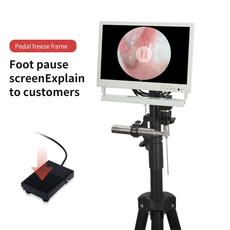 Industrial-grade otoscope endoscope single-line 2.7mm visual ear-picking instrument cold light source adjustable focal length