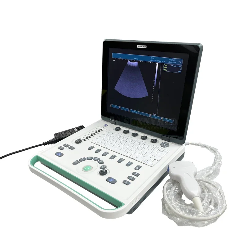 A009 High quality 3D Laptop echographe ultrasound machine portable usg  Gynecology  convex  scanner