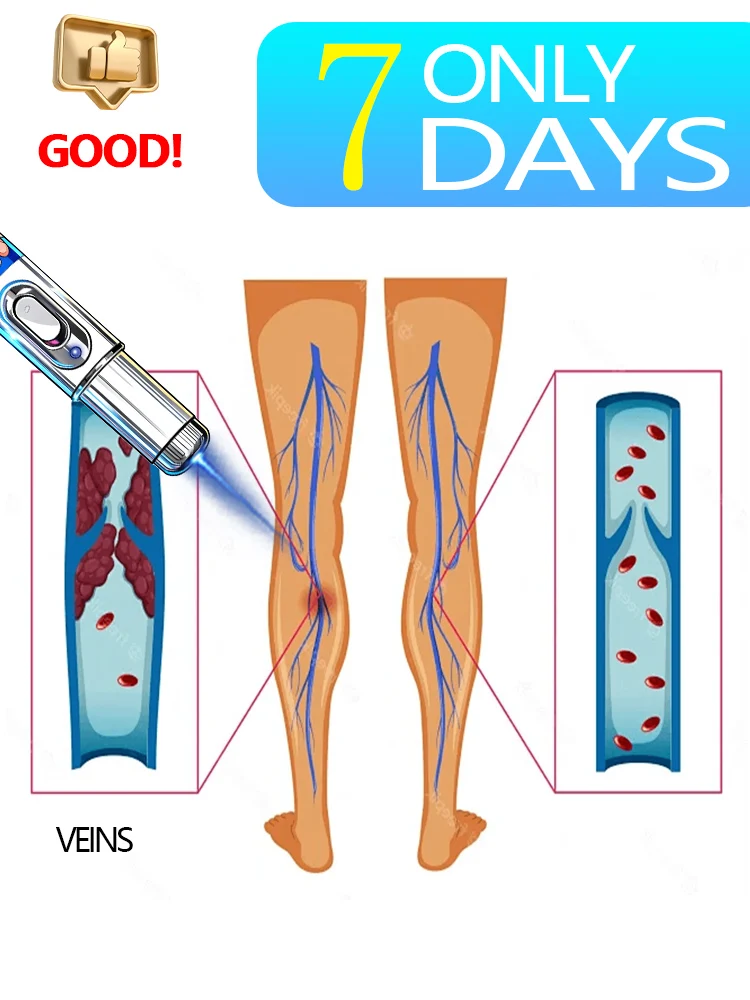 

2025 Инструмент Blue Light Says Goodbye To Legs неделяет