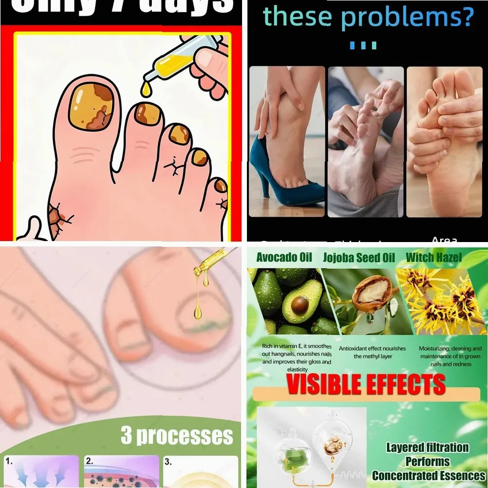 

2025 Toenail Fungus Patch Waterproof Nail Repair Patches Nail Ingrown Correction Sticker Discolored Damaged Nail Foot Care Tool