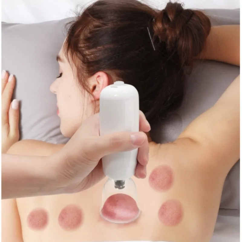 

Electric Negative Pressure Suction Apparatus Cupping Tank Slider Meridian Household Set Shoulder Discomfort Dredging