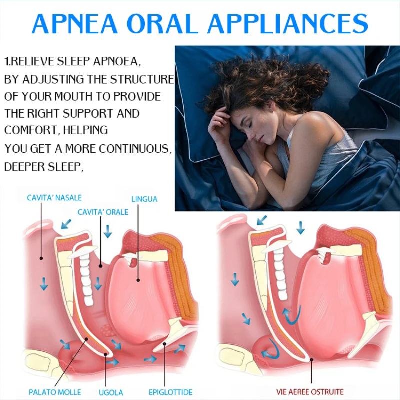 Terapia de Apnea del sueño para adultos, retenedor antidentición, antirronquidos, correctiva, nocturna