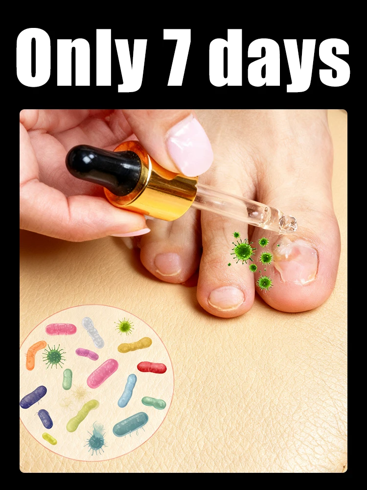 

Быстрое проникновение, ногти становится полупрозрачным и без грибка.