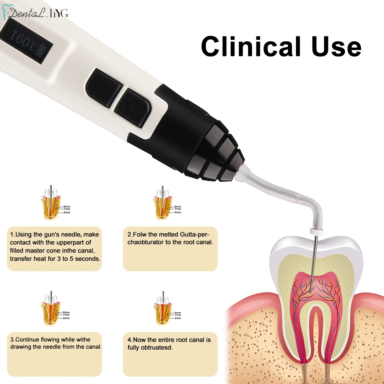 Sistema de obturação endo dental arma aquecimento temperatura caneta dicas sem fio dentista lidar com ferramenta enchimento 3d