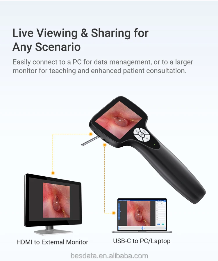 Digital LED Optic Fiber Mini Otoscope Kit BESDATA White Light Mini Video Otoscope Set Optical ENT Rigid Endoscope with Screen