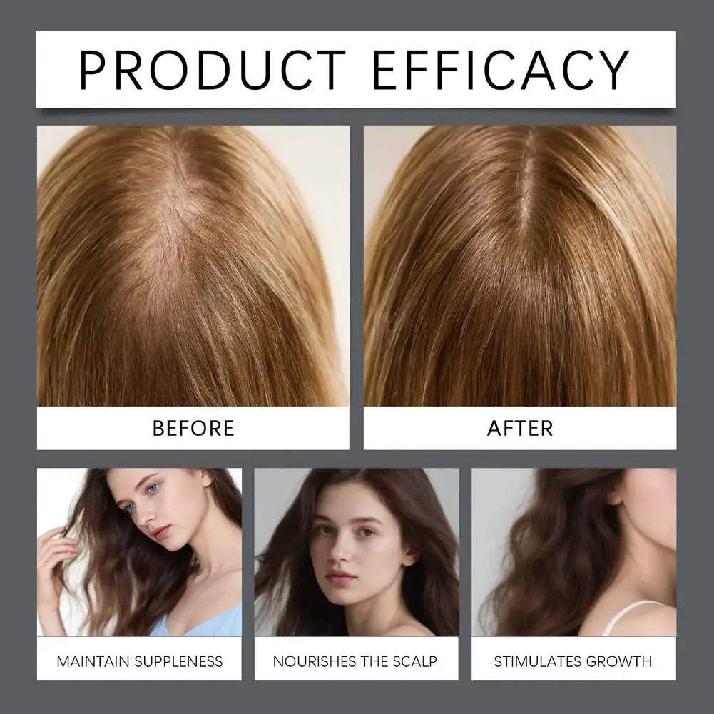 شامبو مغذي لإكليل الجبل لتلف الشعر، تنظيف عميق لزيت فروة الرأس، التحكم في النمو، شامبو تكثيف الجذور