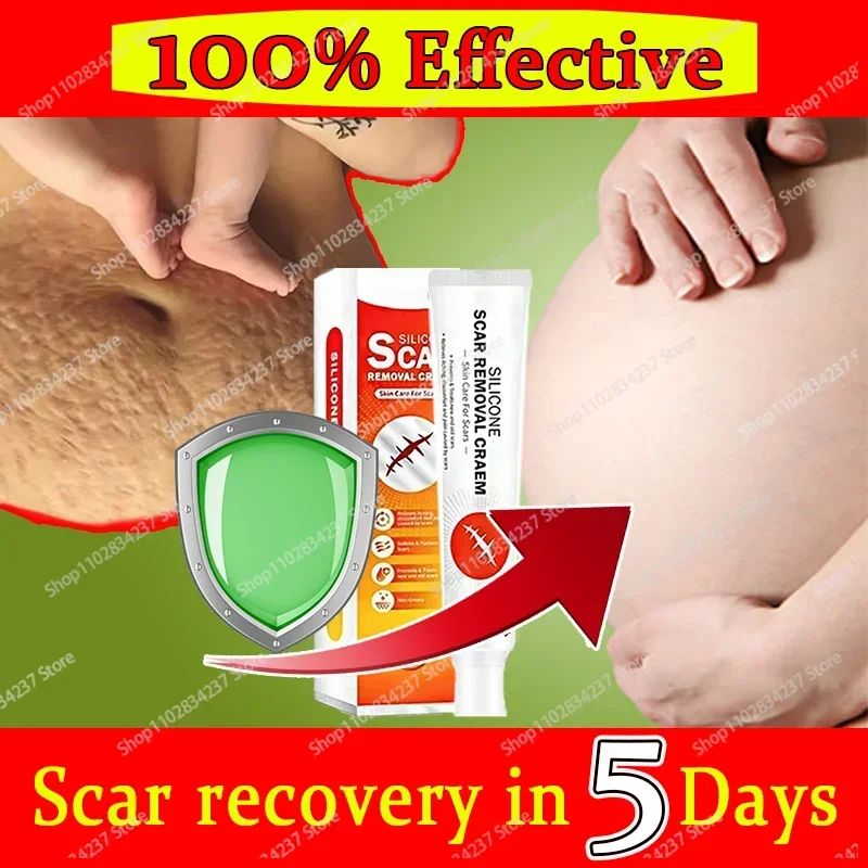 HOT SALE Removes Stretch Mark To Remove Postpartum Obesity Pregnant Women Repair Anti-Aging Winkles Firming Body Skin Care