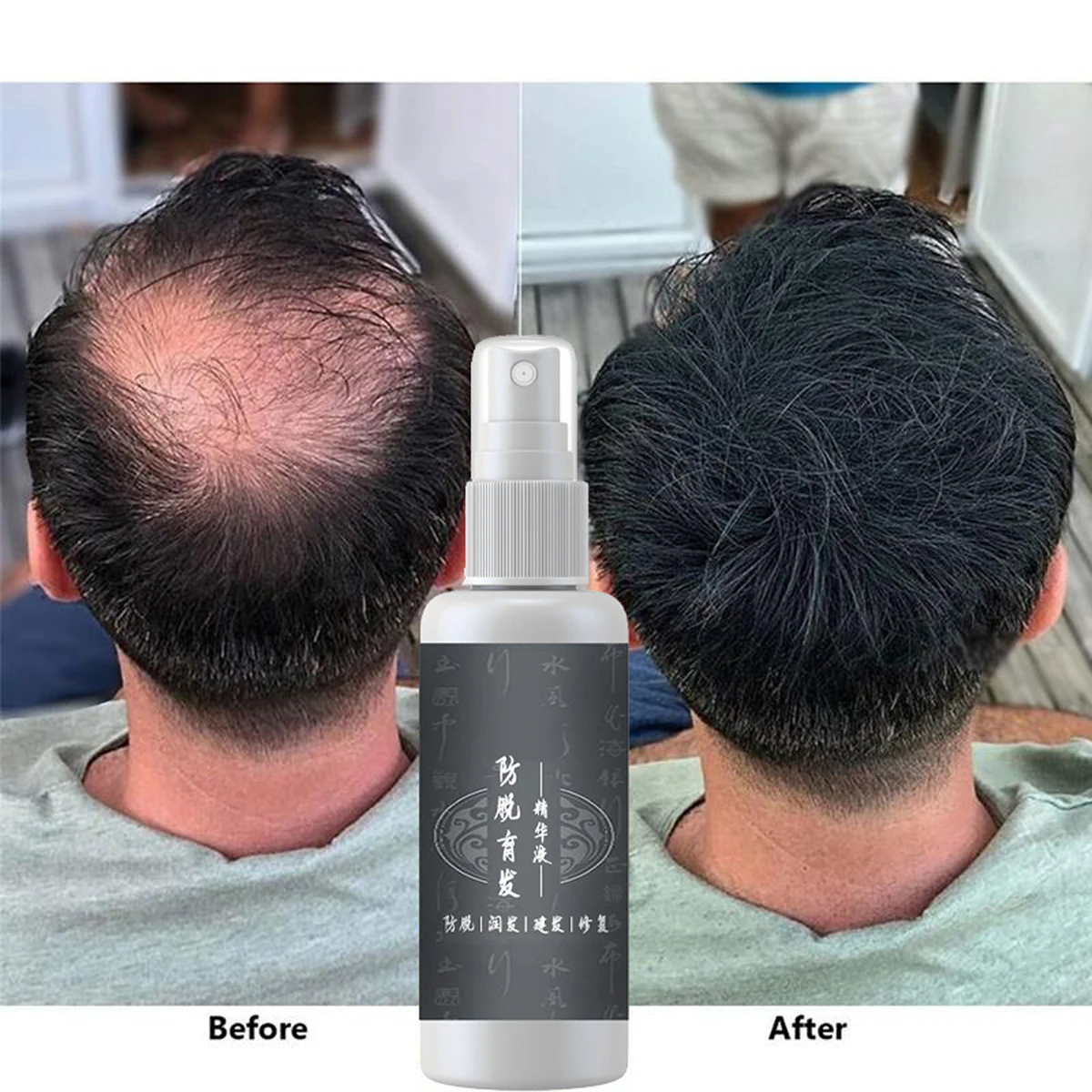 Hair Tonic Serum Fast Growth Serum For Men &Women Head Care Products Anti Hair Loss Serum