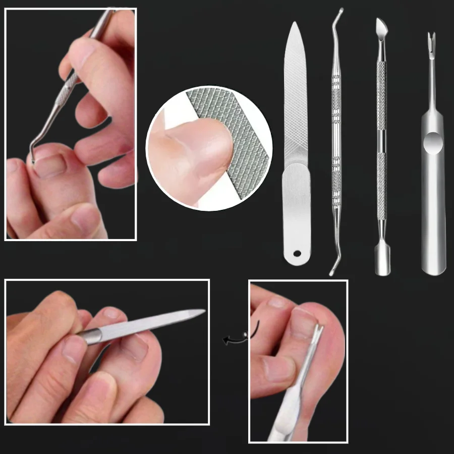 Kit de eliminación y uñas encarnadas de 4 piezas con herramientas de acero inoxidable, incluida lima de uñas, empujador de cutículas-Juego de pedicura profesional