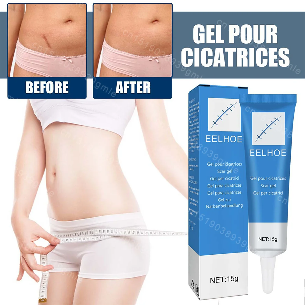 Scar repair gel fast recovery surgery Scar treatment Spot repair Soften stretch mark Burn repair Whitening body care Scar Relief