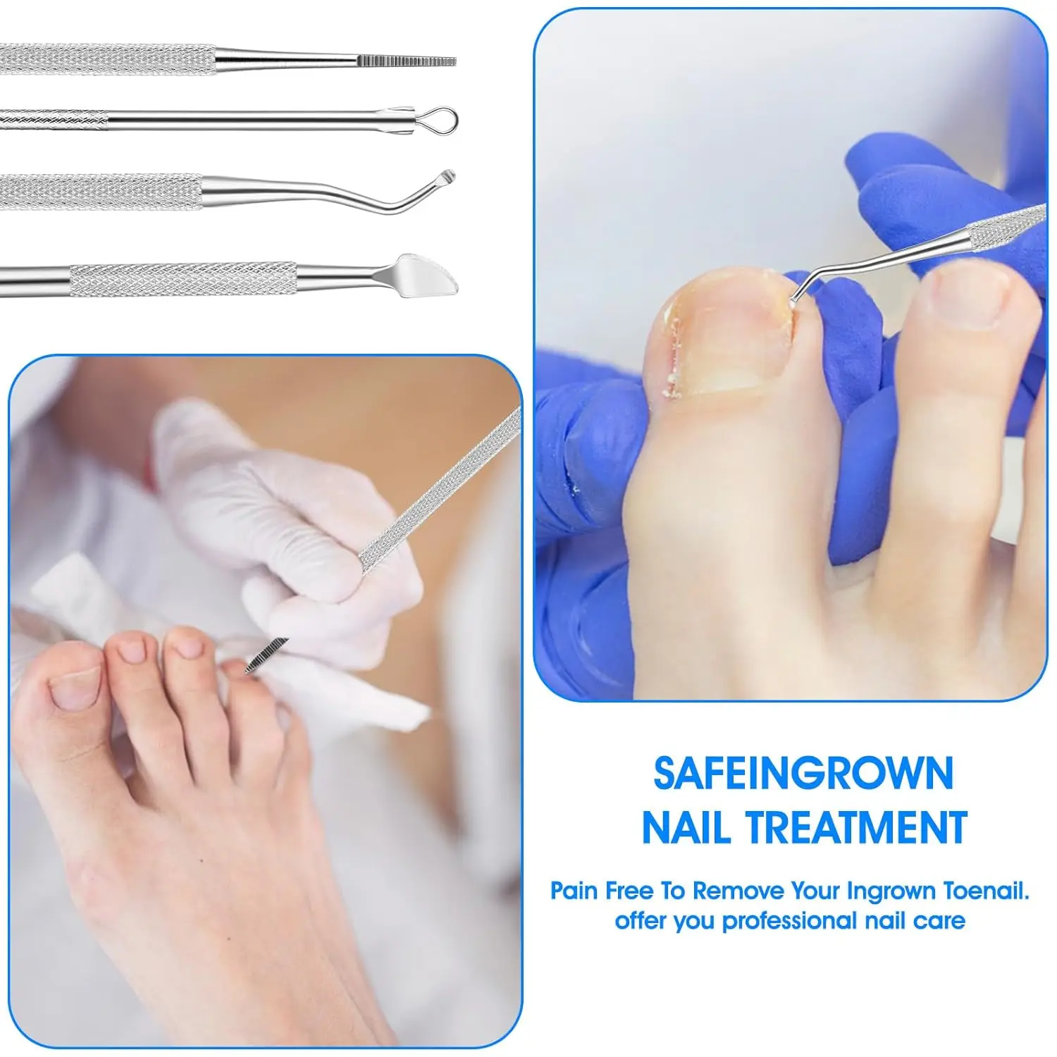 6pcs คุด Toenail เครื่องมือคุด Toenail Treatment Professional สแตนเลสสตีลภายใต้เล็บเครื่องมือทําความสะอาดบรรเทาอาการปวด