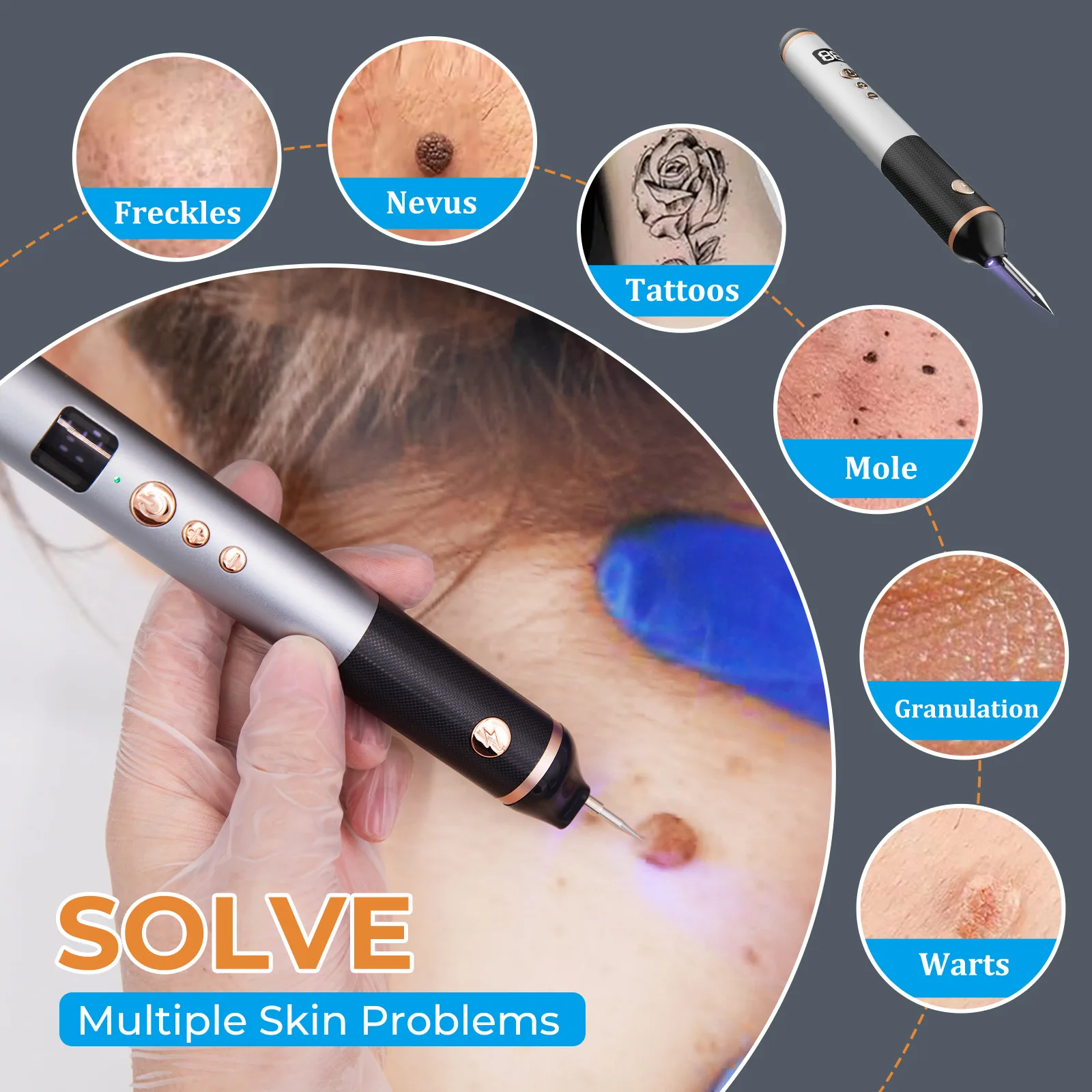 15-gear mole spotting pen, Xiaobai special beauty instrument for spot removal, laser picosecond spot scanning mole pen