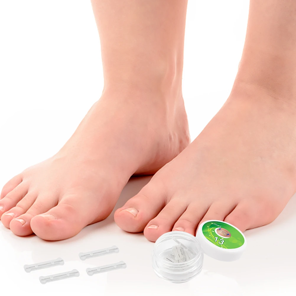 Corrector de uñas de los pies de silicona de aleación de titanio, herramienta reutilizable para uñas encarnadas para aliviar el dolor, cuidado de los pies, uso diario compacto, 10 Uds.