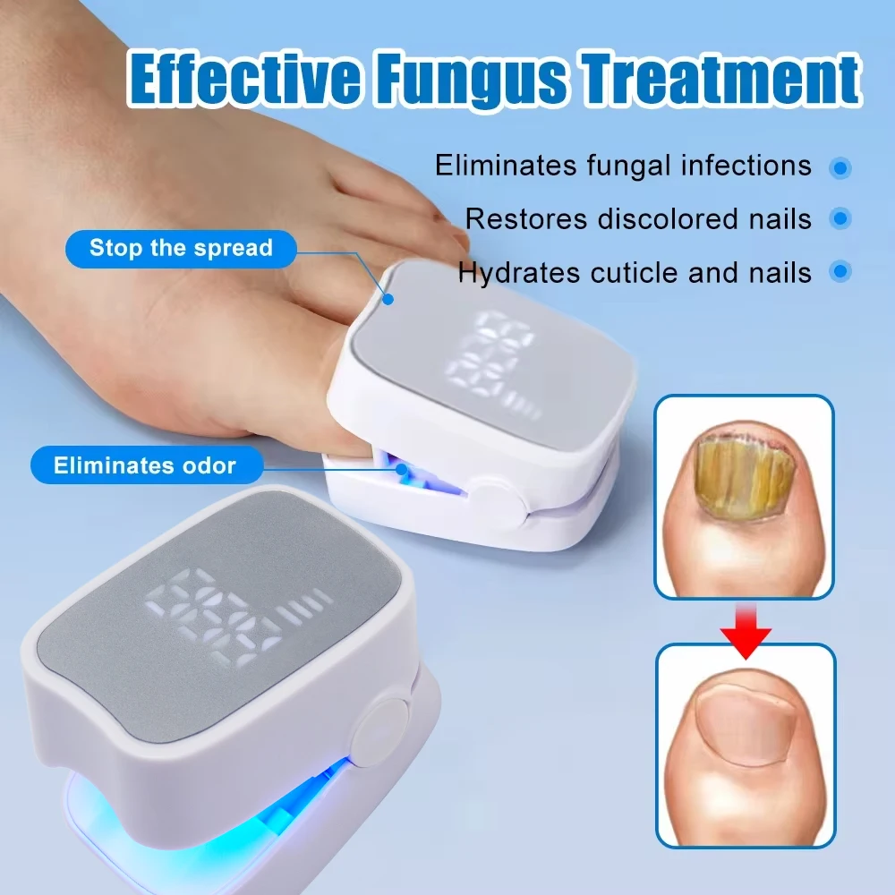 Nail Fungus Laser Device Nail Fungal Treatment Repair Toenail Fingernail Anti Infection Onychomycosis Laser Therapy Machine