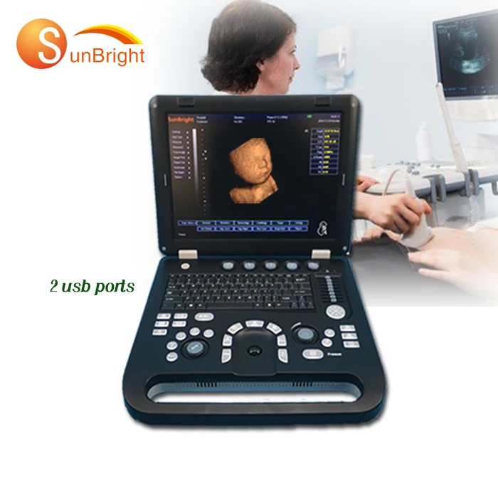 

Portable USG 4D ultrasound machine Laptop color 3D digital ultrasound