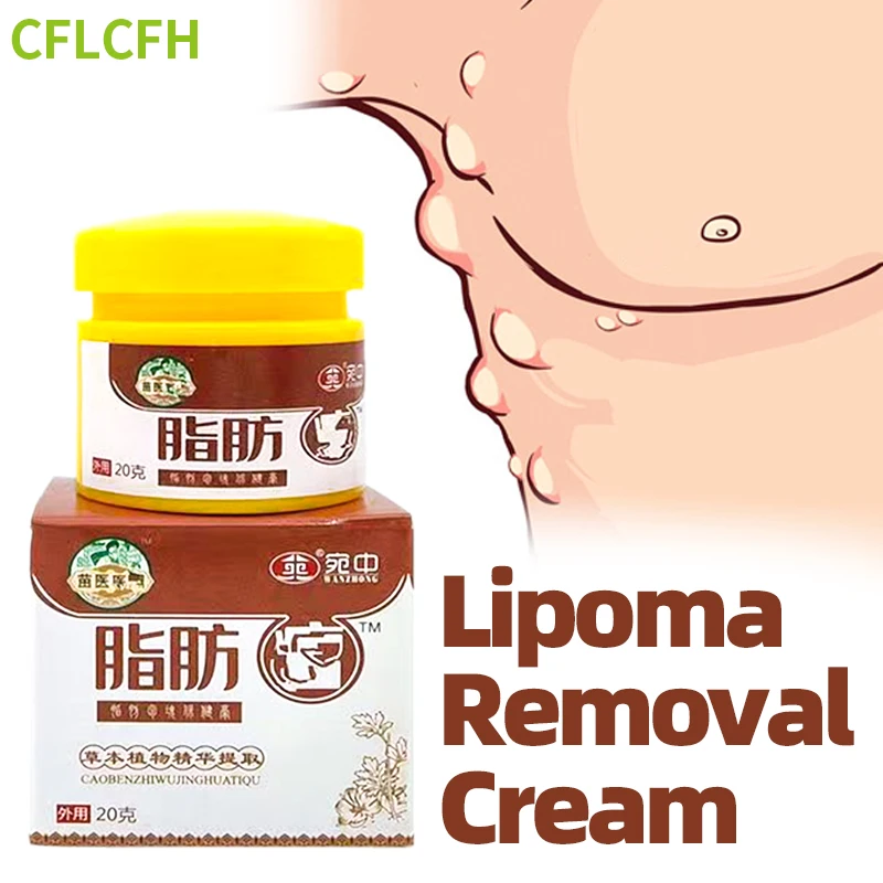 Lipoma Remover Cream 20G Skin Swelling Subcutaneous Lumps Anti-Tumor Cellulite Fibroma Fat Mass Relief Treatment Herbal Plaster