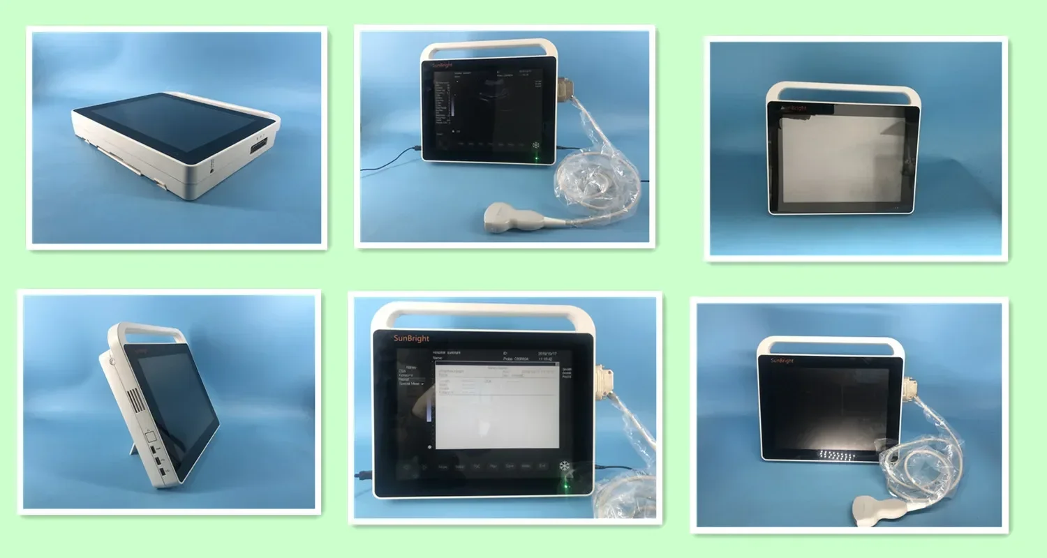 Cheap 2D Portable Echo Ultrasound Machine