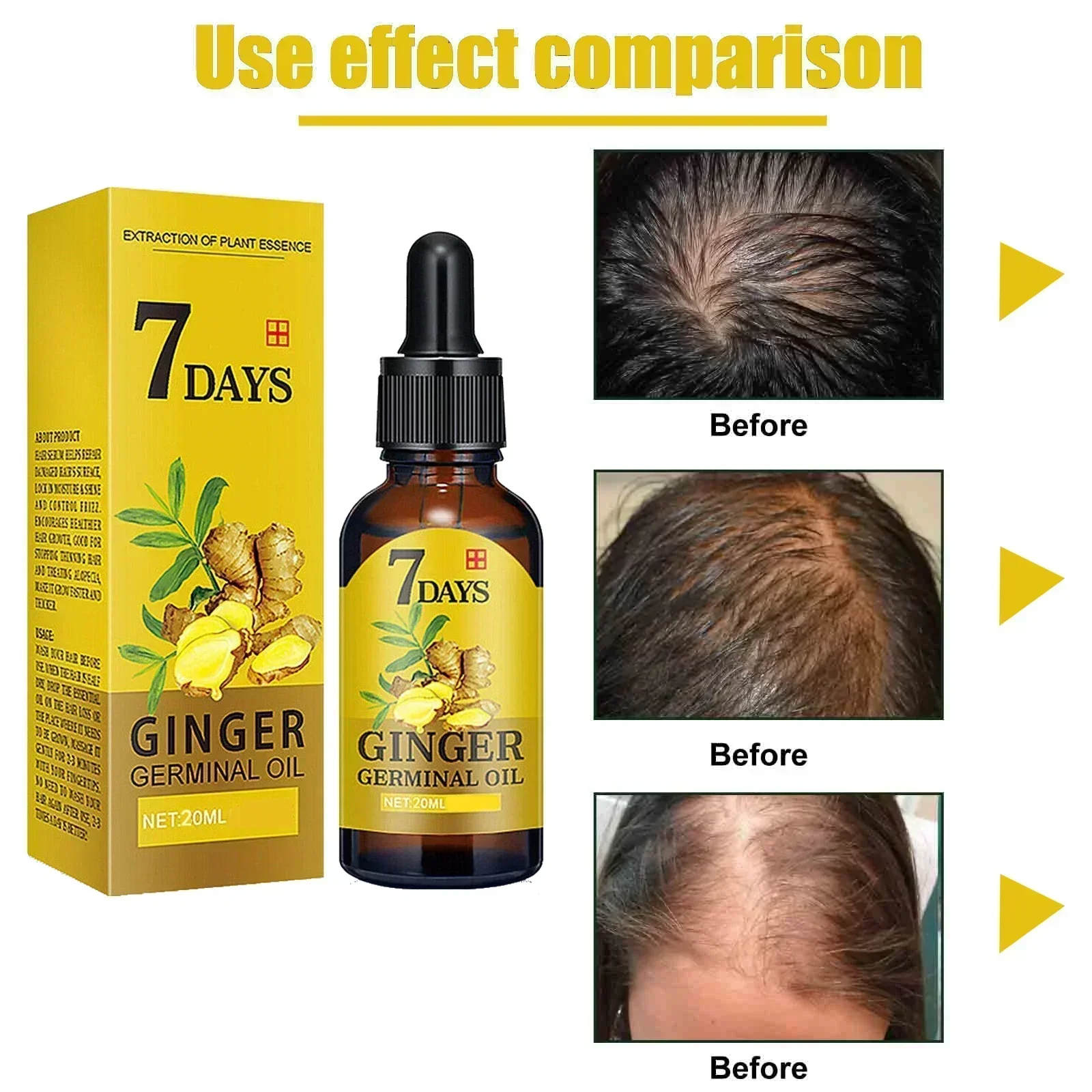 Biotin Ginger Hair Growth Oil, Hair Thicker Essence For Men & Women,  Hair Regrowth Treatment For Stronger Thicker Longer