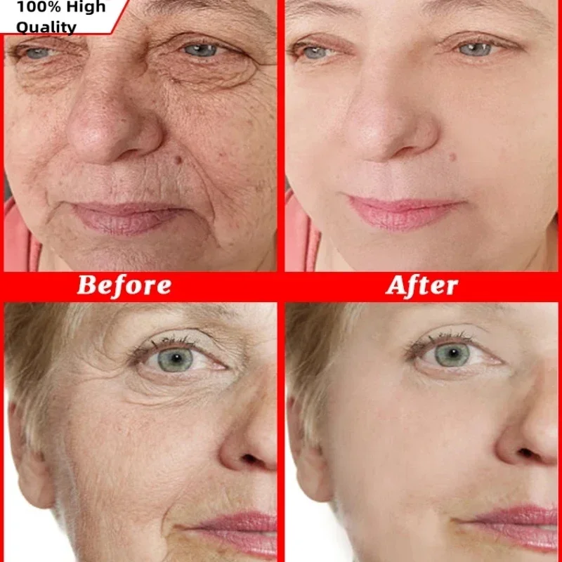 Magische Anti Rimpel Gezichtscrème Instant Lifting Verstevigende Anti-Aging Fade Fijne Lijn Whitening Hydraterende Reparatie Saaiheid Huidverzorging