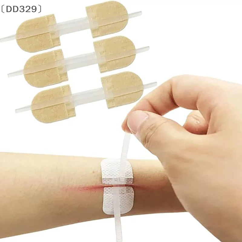 

tipoDD329 август 118/3/10/50 патчей с застежкой-бабочкой, полоски для бинтов, клейкие полоски, строчки, закрывающие раны на коже с антипригарной подушечкой