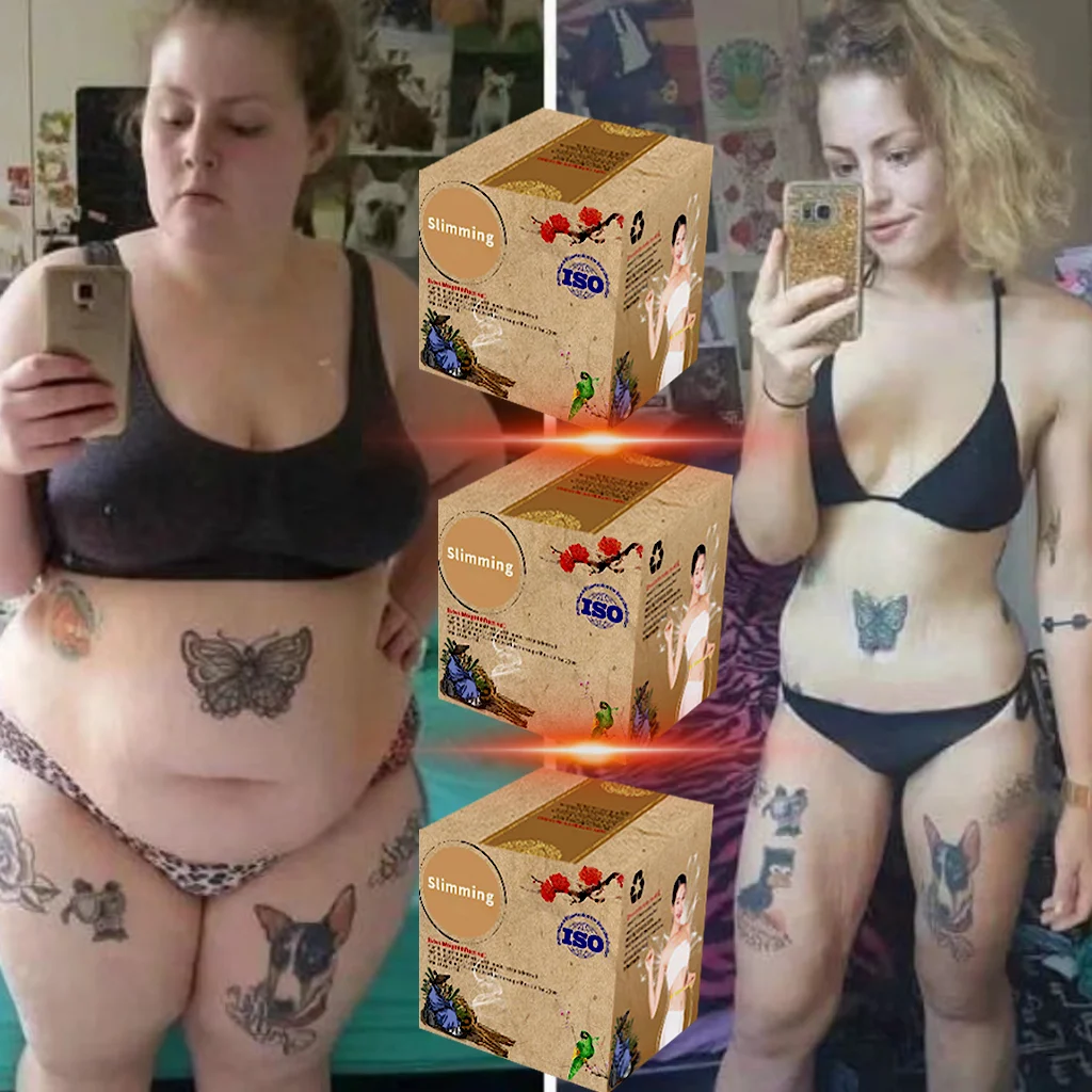 女性の体重減少のためのスリムなステッカー,さまざまな色のへこみ,体重減少,中国の痩身製品