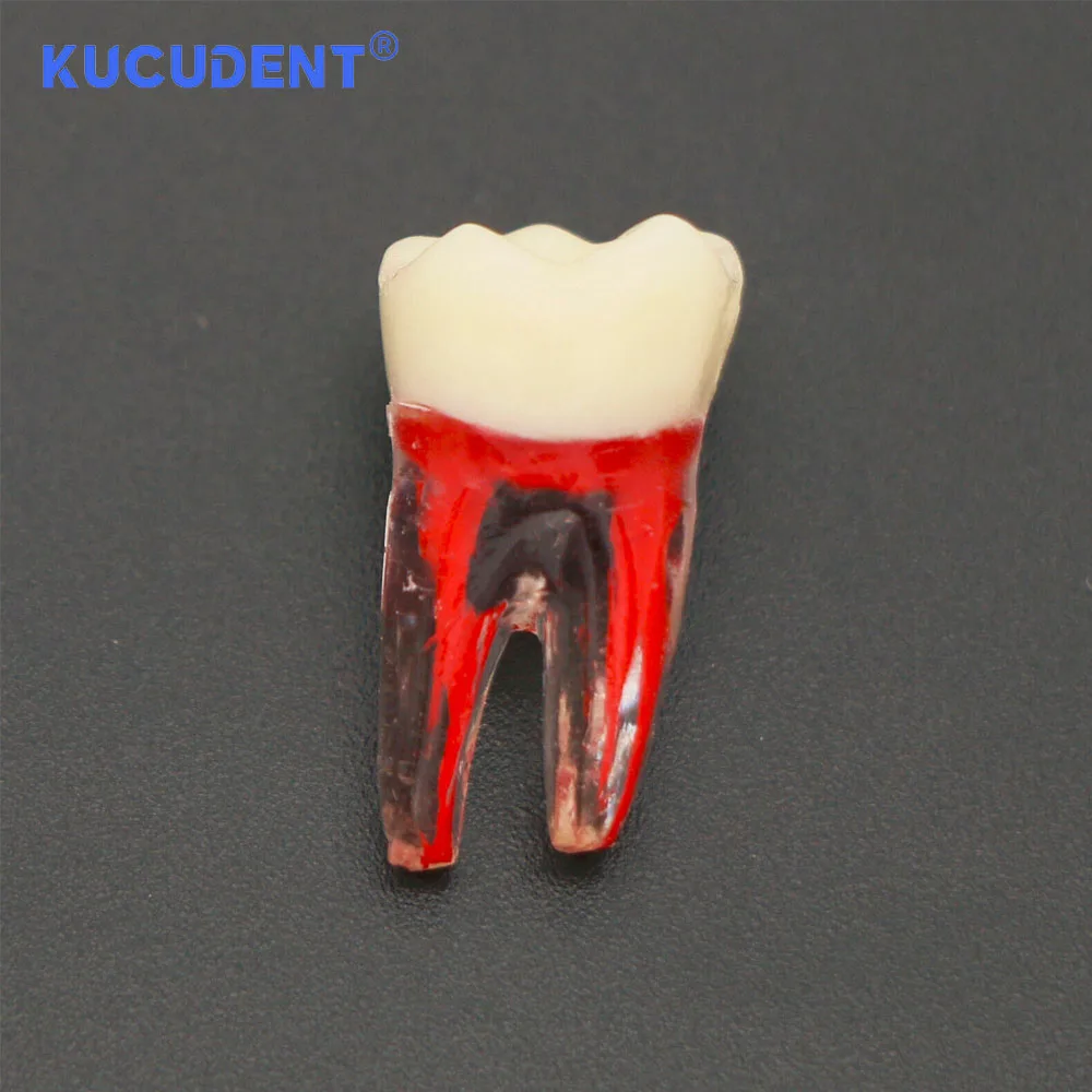 KUCUDENT ทันตกรรม Endodontic Root Canal RCT ฝึก Endo ฟันฟันรุ่น M8007 Pulp Cavity สําหรับทันตกรรมการศึกษาการสอน