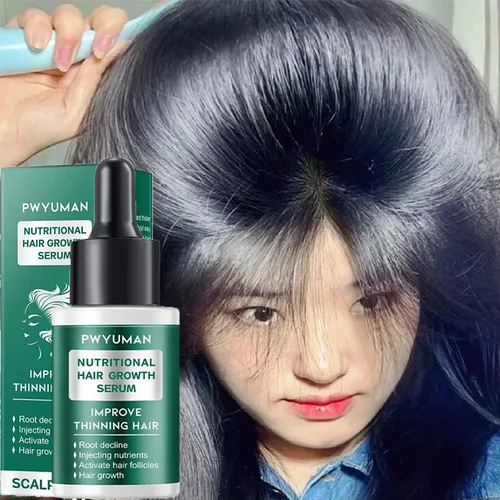 Suero para el crecimiento del cabello de jengibre, 7 días, productos para promover el crecimiento del cabello rápido, reparación antipérdida de cabello, calvicie del cuero cabelludo, nutre el cuidado de la raíz del cabello
