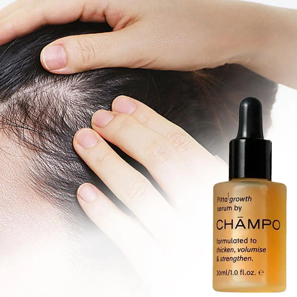 CHAMPO Hair Fast Growth Serum Anti Hair Loss Prevent Baldness Scalp Cure Nourish Strong Roots Enhance Hair Resilience Essence Oi
