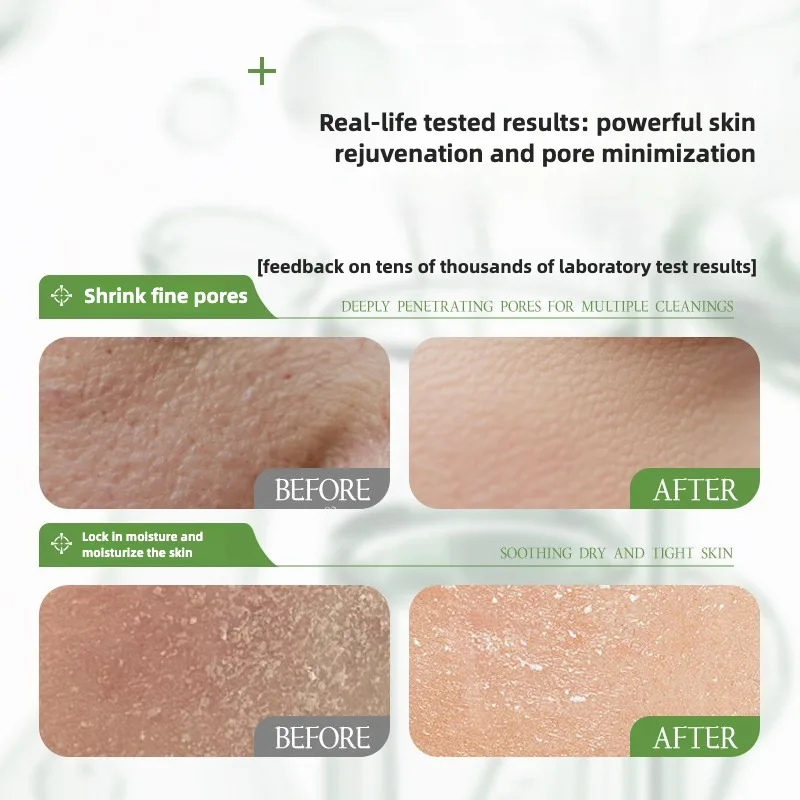 روزماري هيدروسول جوهر ترطيب مصل تتلاشى الخطوط الدقيقة ترطيب الوجه اشراق مكافحة الشيخوخة ثبات العناية بالبشرة #4