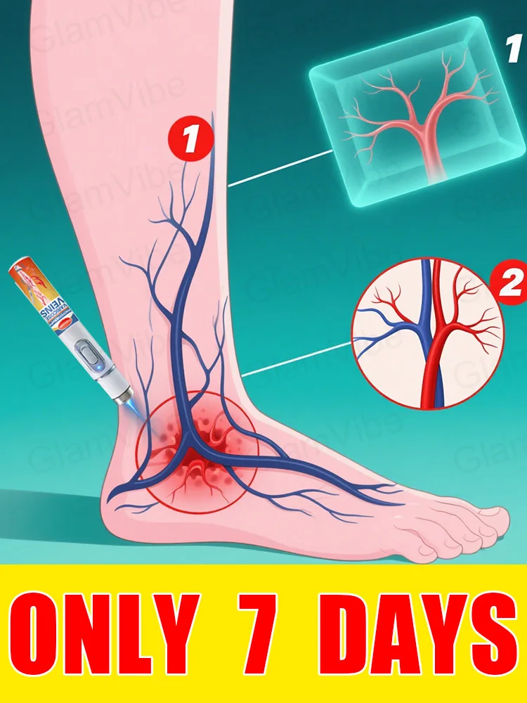 

Generation-2 Laser Says Goodbye To Spider Legs Varicose In 7 Days