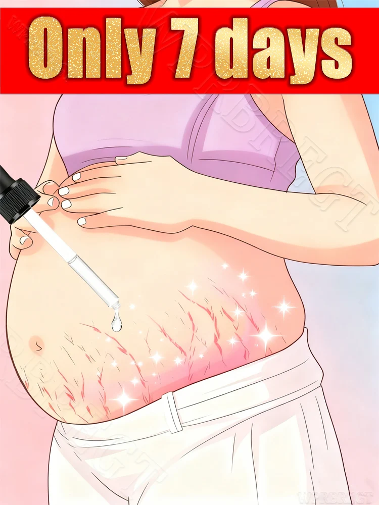 Essential Oil That Can Be Applied To The Thighs And Abdomen To Reduce Stretch Marks.