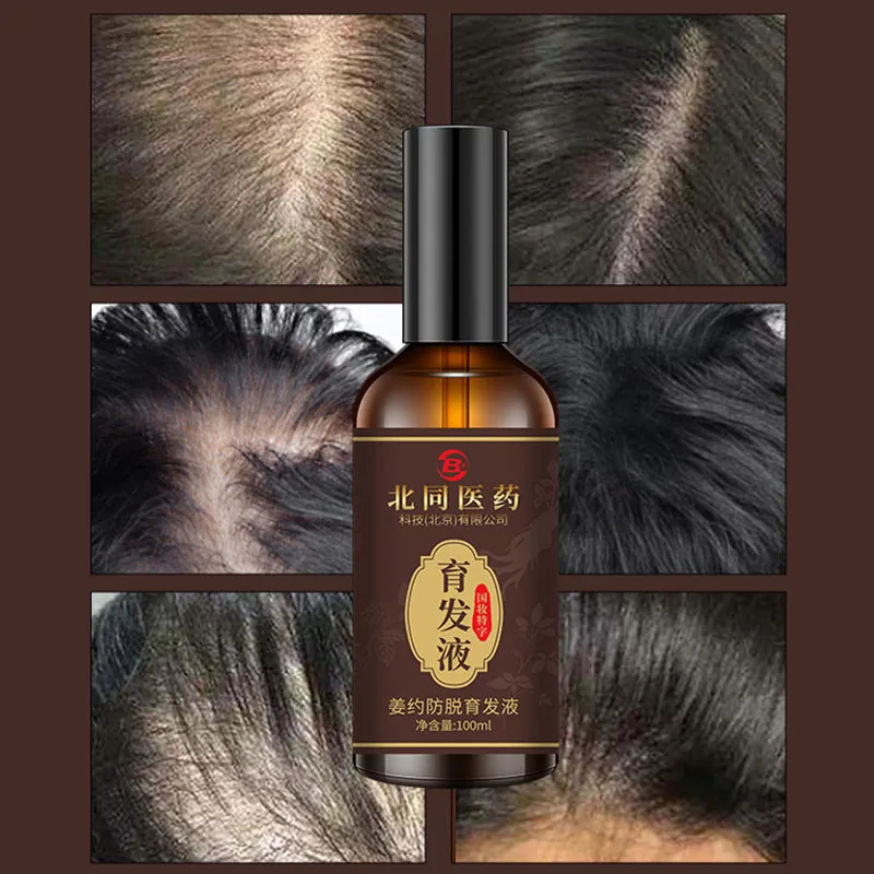 Hair-nourishing liquid improves hairline density and grows rapidly Anti-shedding herbal essence nutrient for men and women