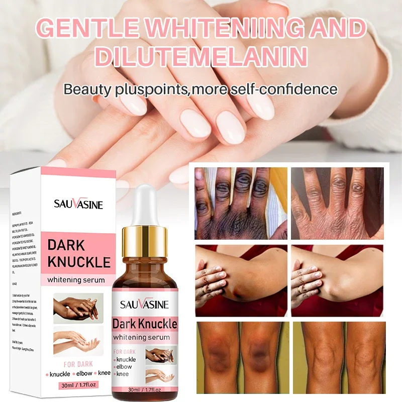 30ml Finger Whitening Essence Oil Serum Remove Finger Knuckle Dark Spots Brighten Hand Knuckle Elbow Knee Smooth Skin Lightening