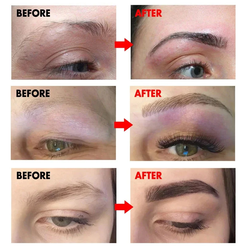 Eyebrow Eyelash Fast Growth Serum Growing Prevent Hair Loss Damaged Treatment Thick Dense Eyes Makeup Care Products Cosmetics