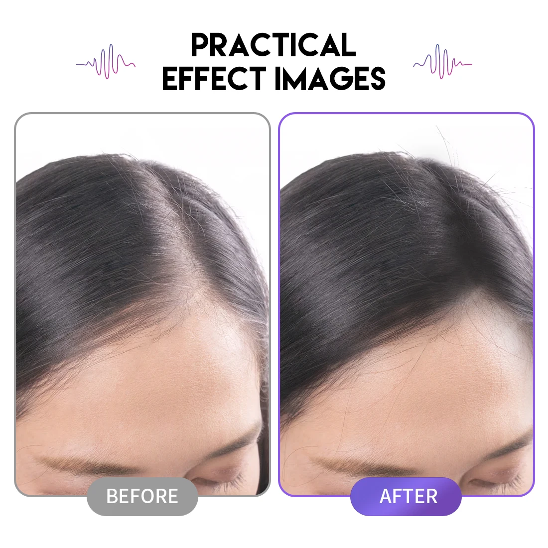 Thumbnail 3 - #2 Rotary Tattoo Machines Comparison Guide