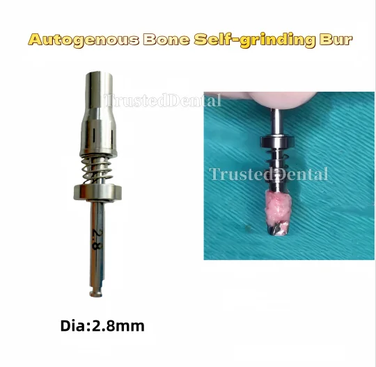 Dental Implant Spring Bone Harvesting Drill Autogenous Self-Grinding Bone Scrap Drill for GBR Bone Collection and Extraction