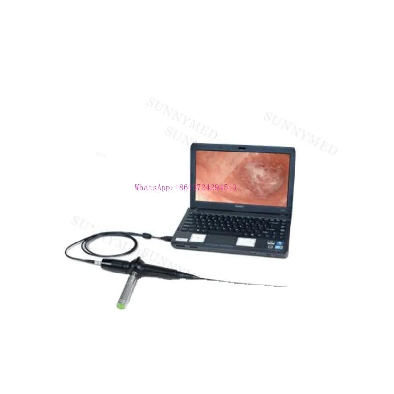 P036 Portable video flexible pet vet veterinary endoscope bronchoscope for small animal dog cat 1.2 mm working channel 3.0mm ENT