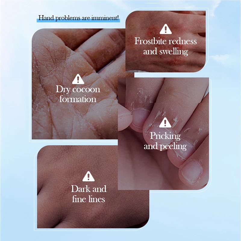 SADOER جوز الهند ترطيب قناع اليد تبييض مغذي مكافحة الشيخوخة ترطيب قفازات اليد لمنتجات العناية بالبشرة اليدين