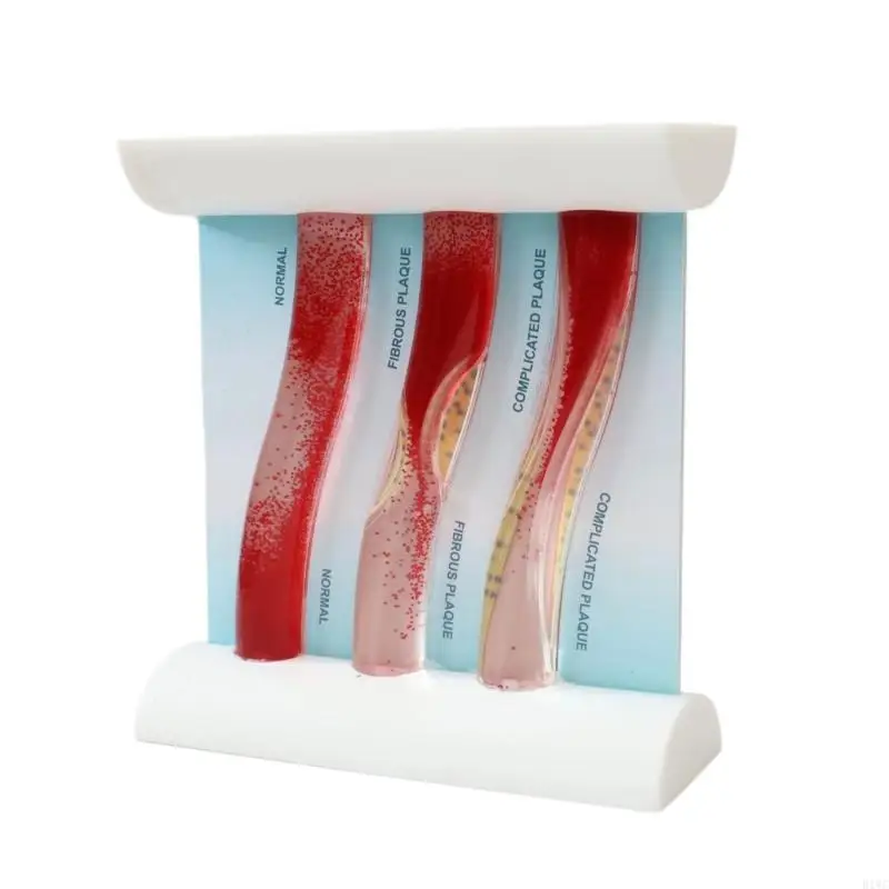 Enlarged Human Blood Vessel Educational Model For Classroom Demonstration And Study 