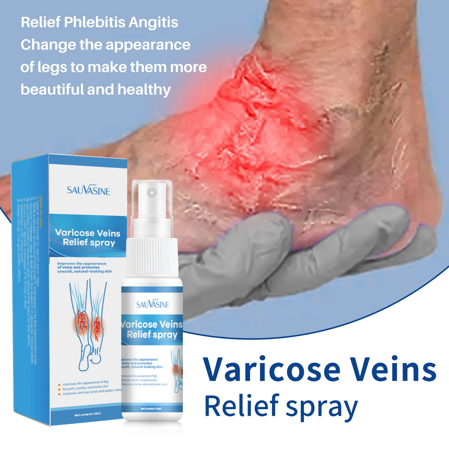 

Venous Massage Varicose Spray To Smooth Earthworm Legs Leg Blood Vessel Protruding Massage Spray