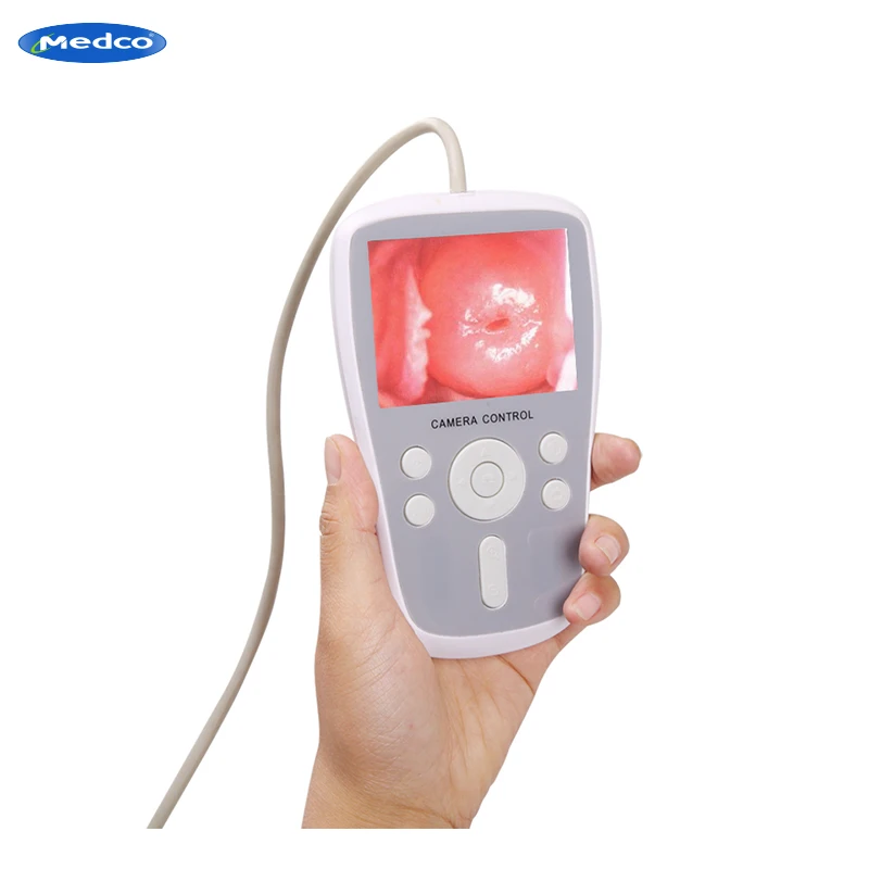 Portable Digital Colposcope  Mini Gynecology Video Colposcope LED Video Display Electronic Colposcope