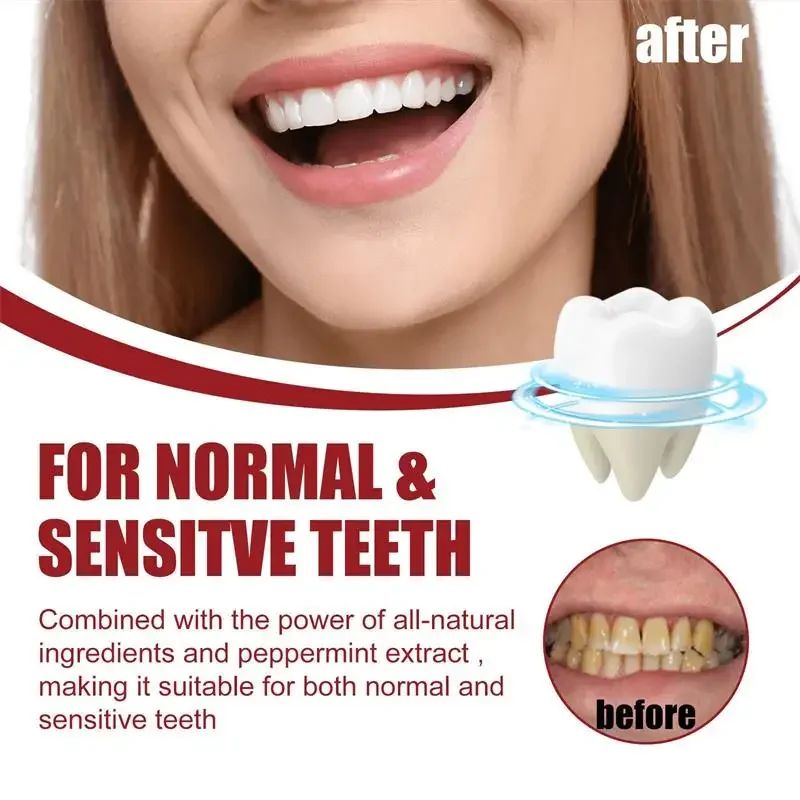 SP-6 Probiotic Toothpaste Remove Plaque Stain Whiten Teeth Protect Gum Teeth Oral Hygiene Clean Fresh Breath Dental Care Product