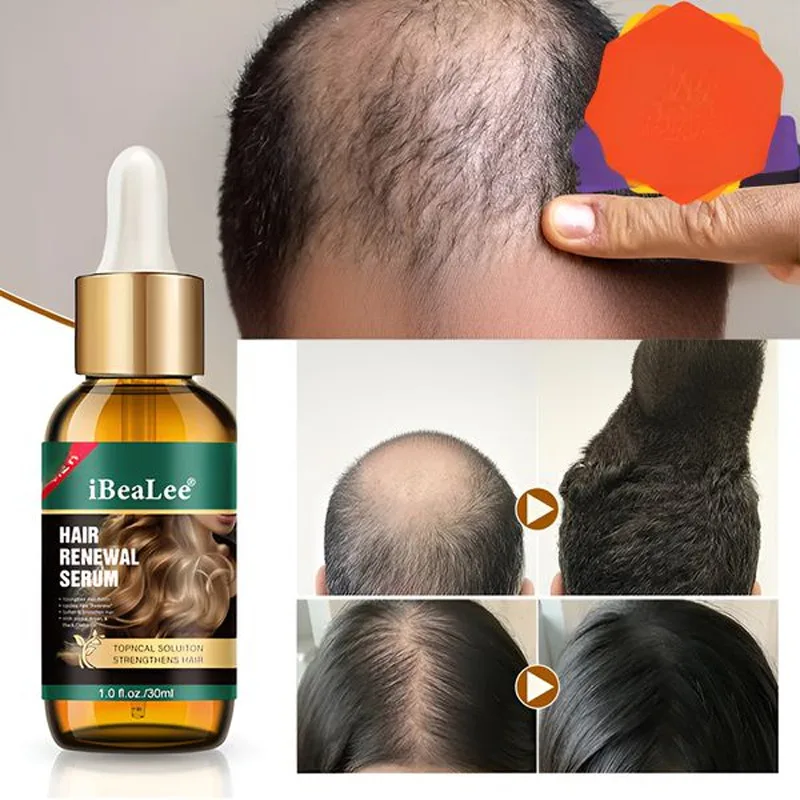Línea de cabello Esencia de trigo anti pérdida de cabello humano fuerte, aceite de cuidado nutricional, densidad del cabello