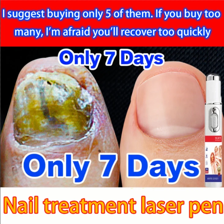 

Nail Fungal Laser Treatment Device Repair Anti Infection Paronychia Onychomycosis Ingrown Toenail Foot Care Essence