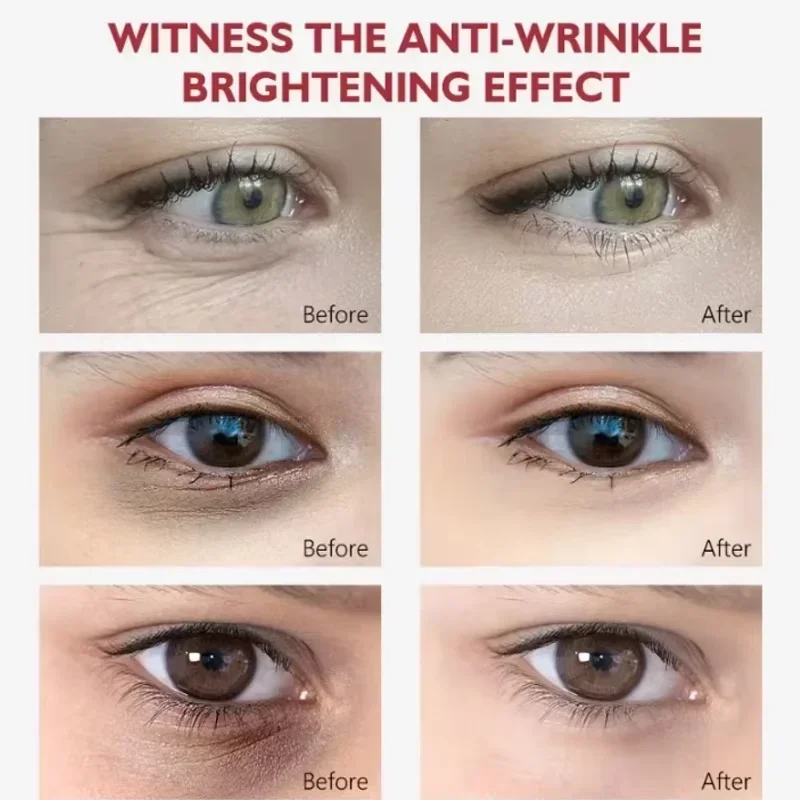 الريتينول كريم عين الكولاجين متعدد بلسم عصا تقليل التجاعيد كيس العين حمض الهيالورونيك مكافحة الهالات السوداء الانتفاخ منتجات العناية بالعين