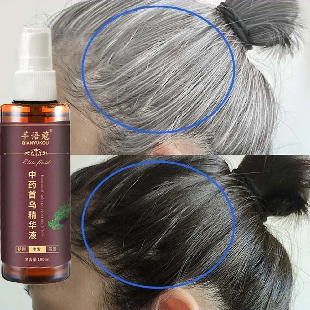 

100ml Liquid Herbal Cure White Hair Treatment Spray Oil Essence Control Hair Shampoo Black Moisturizing Hair Oi D0B8