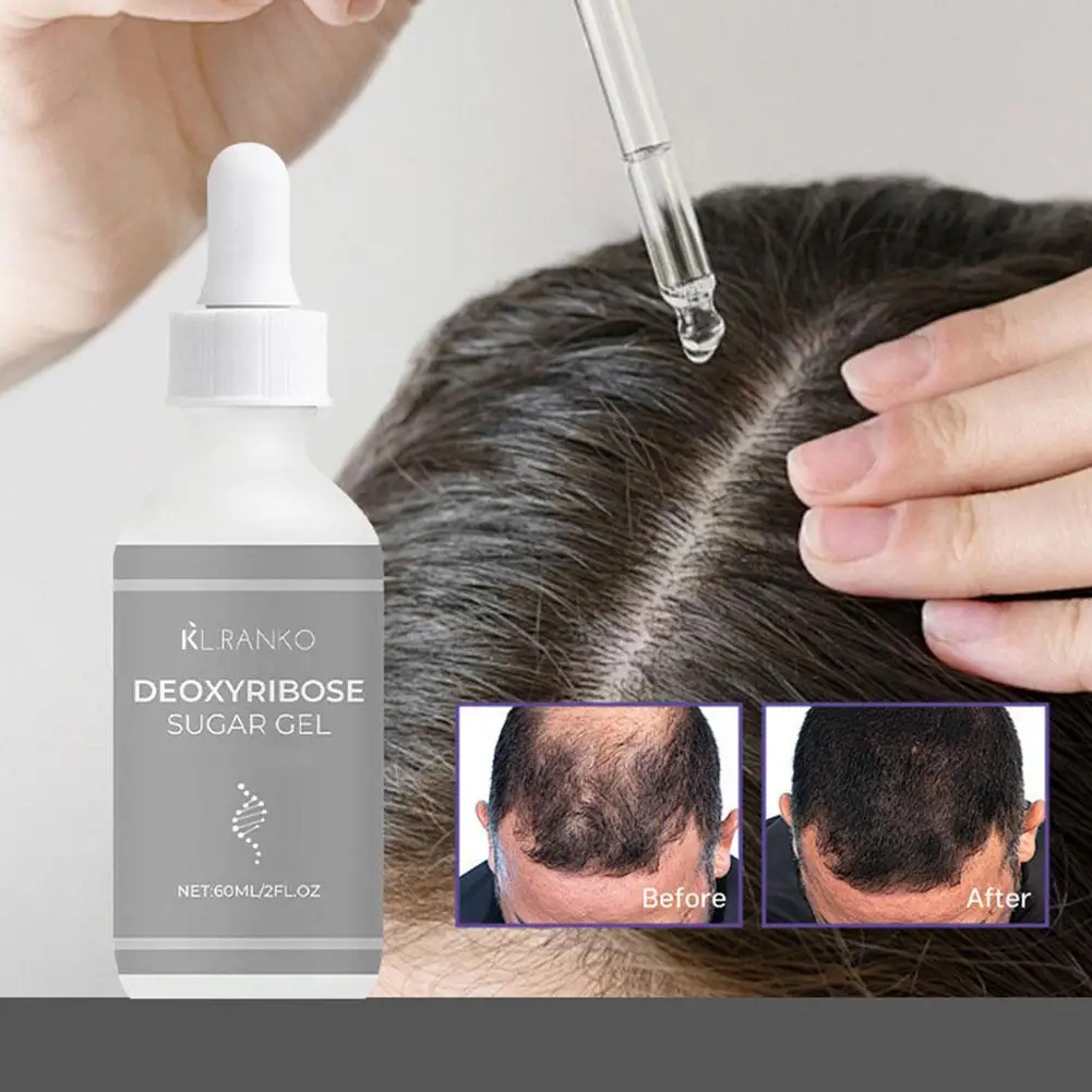 

Эфирное масло для ухода за волосами имбиря, питание кожи головы, волосяные фолликулы, нежное питательное средство, освежение раствора, масло для контроля корней волос, укрепление W2H4